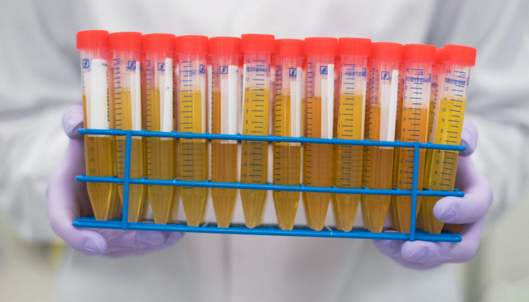 New program allowing queer men to donate plasma is a first step toward ending the blood ban